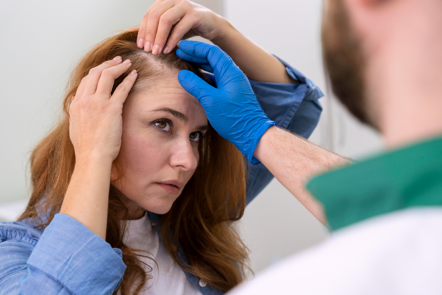 Why Women Choose Hair Transplant
